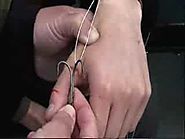 Fish hook removal technique