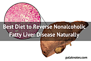 Best Diet to Reverse Nonalcoholic Fatty Liver Disease Naturally