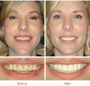 Cosmetic Dentistry and More - Lafayette, Lake Charles, New Iberia - Adrian M. Simm, D.D.S.