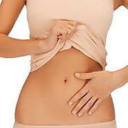 Average Cost of Liposuction in Los Angeles -Free Consultation