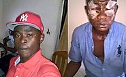 Man Completely Goes blind after he was attacked with acid in Anambra (Graphic Photos) - Groovenaija360.com.ng