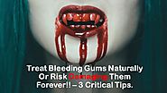 Treat Bleeding Gums Naturally OR Risk Damaging Them Forever!