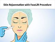 Skin Rejuvenation with FaceLift Procedure