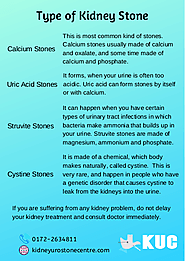 Type of kidney stone
