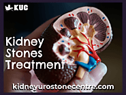Kidney Stones Treatment Hospital