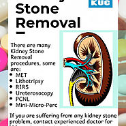 Kidney Stone Removal Services