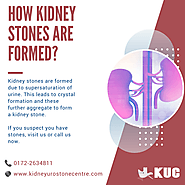 How Kidney Stones are formed?