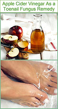 Apple Cider Vinegar As a Toenail Fungus Remedy | Listerine Foot Soak