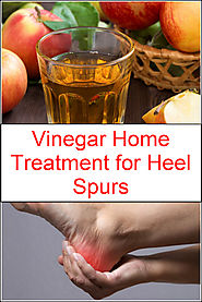 Vinegar Home Treatment for Heel Spurs | Listerine Foot Soak