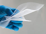 Quick Read On The Complications Of Surgical Mesh