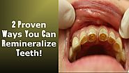 2 Little Known Ways To Achieve Tooth Remineralization: Easy To Implement !