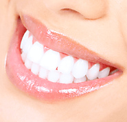 You Better Go In For Teeth Whitening Eastern Suburbs Melbourne!