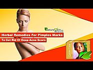 Herbal Remedies for Pimples Marks to Get Rid of Deep Acne Scars