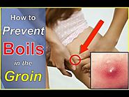 How to Prevent Boils in the Groin Area