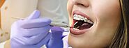 Get the Best Orthodontic Treatment in Ontario - DS Dental