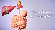 Liver Transplantation at Affordable Price