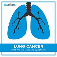 Lung Cancer Treatment in India | MedMonks