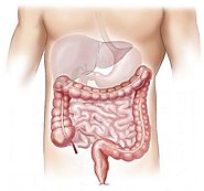 Treatment Of Bowel Disease Using Stem Cell Therapy