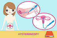 Hysteroscopic surgery - Best Gynecologist in Mumbai | Gynaecology doctors India