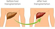 Take care of the key player in your body- LIVER | MedMonks