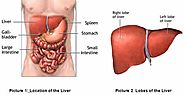 What is Cost of Liver Transplant in India