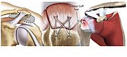 Rotator Cuff Injury Treatment India | Arthroscopic Rotator Cuff Surgery Coimbatore