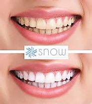Snow Teeth Whitening Kits – Snow Teeth Whitening