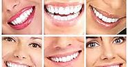 Snow Teeth Whitening Reviews, Coupon & Discount Code: Snow Teeth Whitening Discount Code - Exclusive Teeth-Whitening ...
