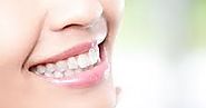 Snow Teeth Whitening Reviews, Coupon & Discount Code: Experience The Fastest Home Dental-Whitening Treatment With Sno...