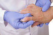 Beware: Early Warning Signs of Rheumatoid Arthritis