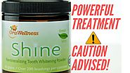 Not So SHOCKING reason why Shine Is The Best Teeth Whitening Powder On The Planet!