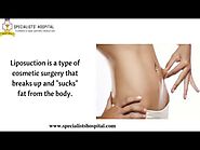 Liposuction Surgery In Kochi | Fat Removal Treatment In Kerala | Body Reshaping In India