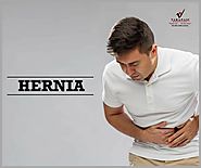 What Are The Most Common Types Of A Hernia?