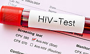 How To Find HIV Treatment Services