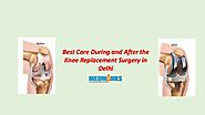 Best Care During and After the Knee Replacement Surgery in Delhi