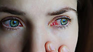 Some effective causes & treatment for corneal abrasion