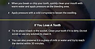 How to Repair Your Cracked or Broken Tooth