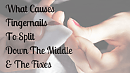 What Causes Fingernails To Split Down The Middle & The Fixes