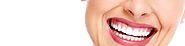 All-On-4 Dental Implants Sydney | Sedation Dentist Penrith