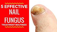 5 Effective Nail Fungus Treatment Routines - Home Remedies for Toenail Fungus