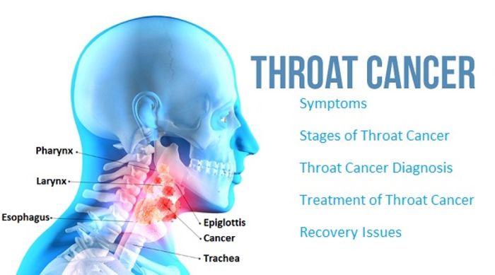 Top 5 Hospitals for Throat Cancer Treatment | A Listly List