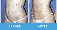 Know more about Vaser Liposuction