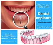 Affordable Dental Implants at Padstow and Stanhope Gardens