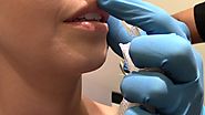 Dr. Arash Akhavan: Lip Injections in NYC