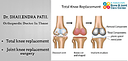 Learn about various types of implants used in the total hip replacement surgery | Bone And Joint Care Center