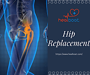 Best Hip Replacement Surgeons in India