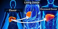 2 Types of Liver Transplant