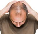 4 Ways To Fight Hair Loss