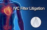 IVC Filter Legal Claims and Lawsuits