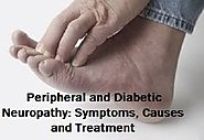 Peripheral and Diabetic Neuropathy: Symptoms,... - Health Questions & Answers